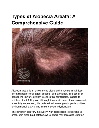 types of alopecia areata a comprehensive guide