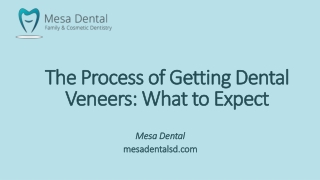 the process of getting dental veneers what to expect