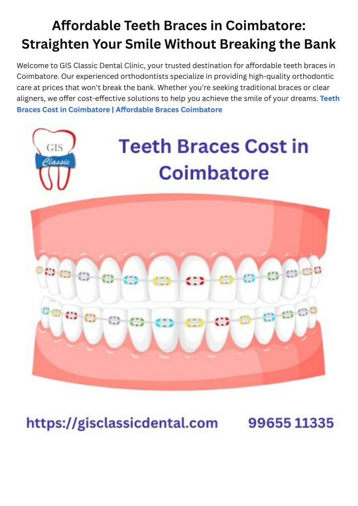 a ordable teeth braces in coimbatore straighten