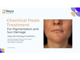 Chemical Peels Treatment for Pigmentation and Sun Damage | Dr Ravali