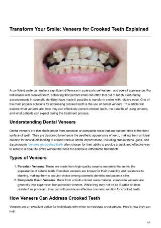 Transform Your Smile Veneers for Crooked Teeth Explained