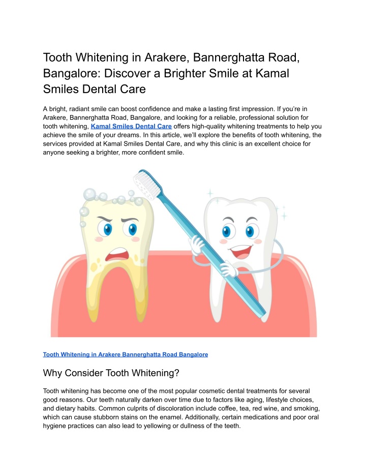 tooth whitening in arakere bannerghatta road