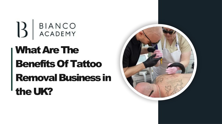 what are the benefits of tattoo removal business