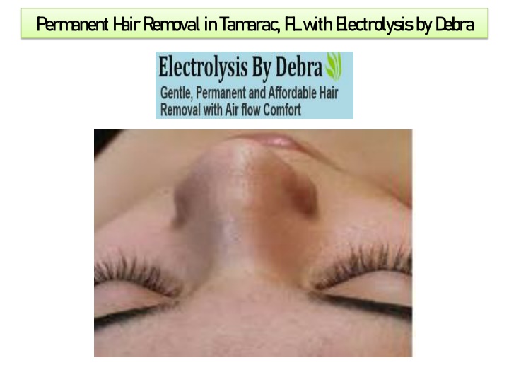 permanent hair removal in tamarac fl with