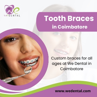 tooth braces in coimbatore