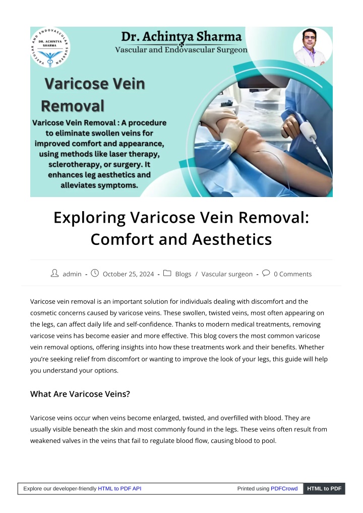 exploring varicose vein removal comfort