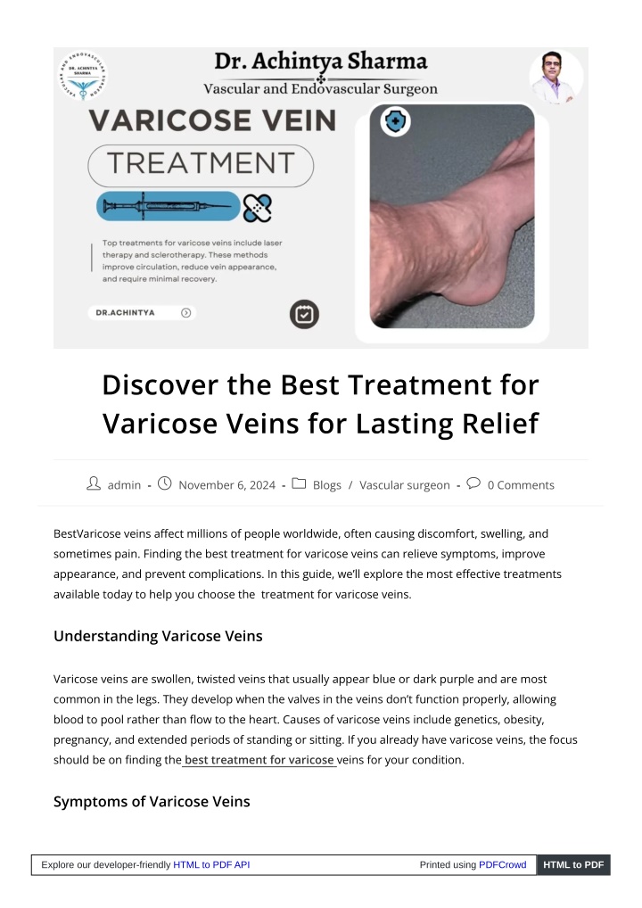 discover the best treatment for varicose veins