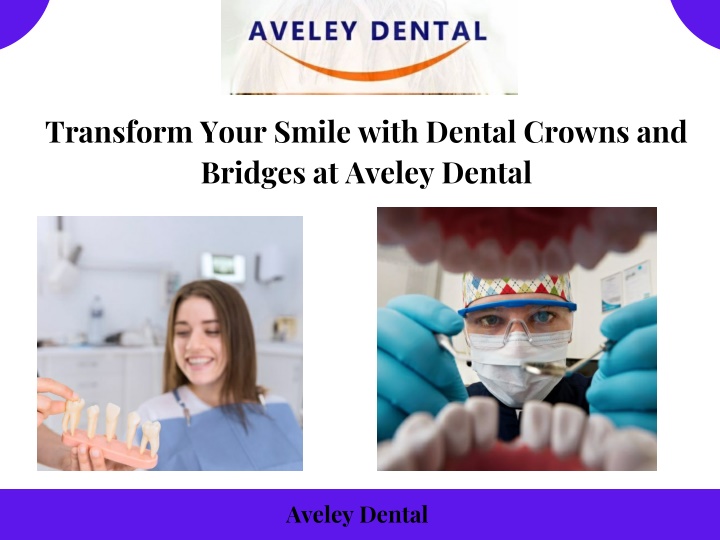 transform your smile with dental crowns