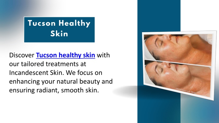 tucson healthy skin