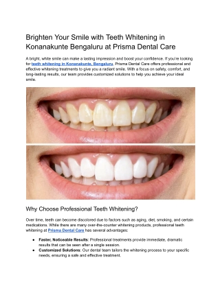 Brighten Your Smile with Teeth Whitening in Konanakunte Bengaluru at Prisma Dental Care