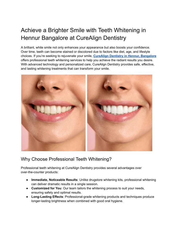 achieve a brighter smile with teeth whitening