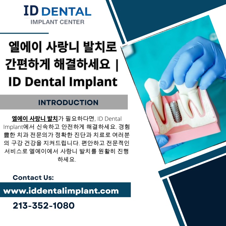 i d dental i mplant id dental implant