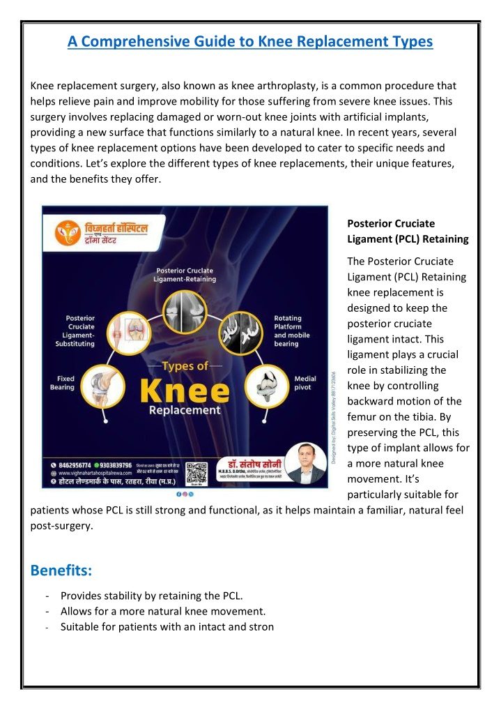 a comprehensive guide to knee replacement types