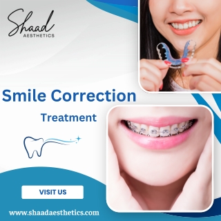 smile correction treatment