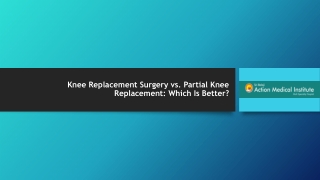 Knee Replacement Surgery vs. Partial Knee Replacement: Which Is Better?