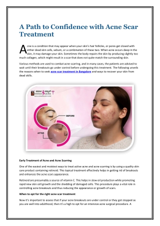 a path to confidence with acne scar treatment a