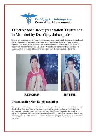Effective Skin De-pigmentation Treatment in Mumbai by Dr. Vijay Jobanputra