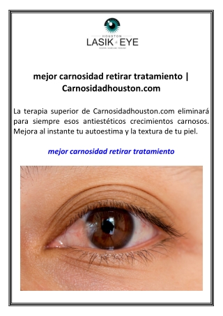 mejor carnosidad retirar tratamiento Carnosidadhouston.com