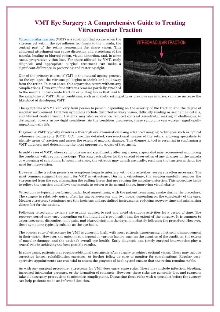 vmt eye surgery a comprehensive guide to treating