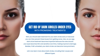 GET RID OF DARK CIRCLES UNDER EYES WITH PROMISING TREATMENTS!