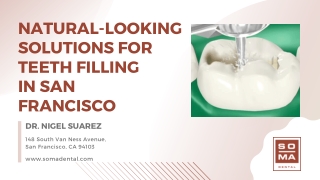 Natural-Looking Solutions for Teeth Filling in San Francisco