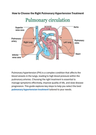 How to Choose the Best Pulmonary Hypertension Treatment