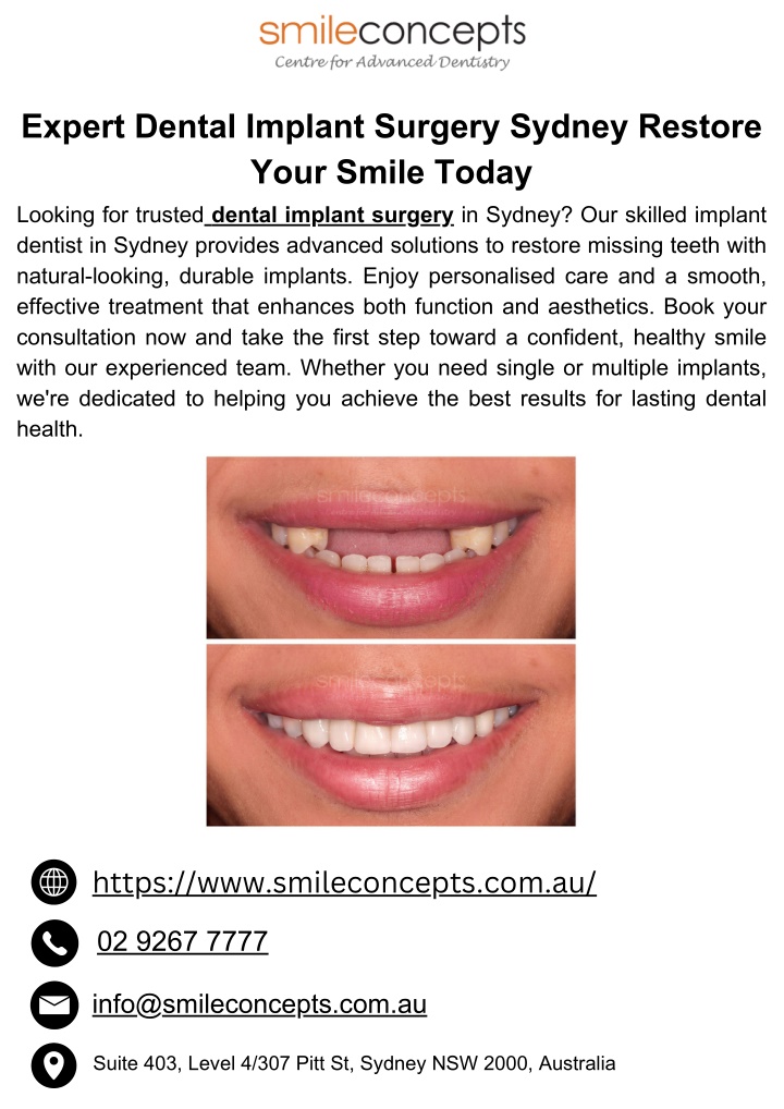 expert dental implant surgery sydney restore your