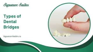 Understanding the Types of Dental Bridges