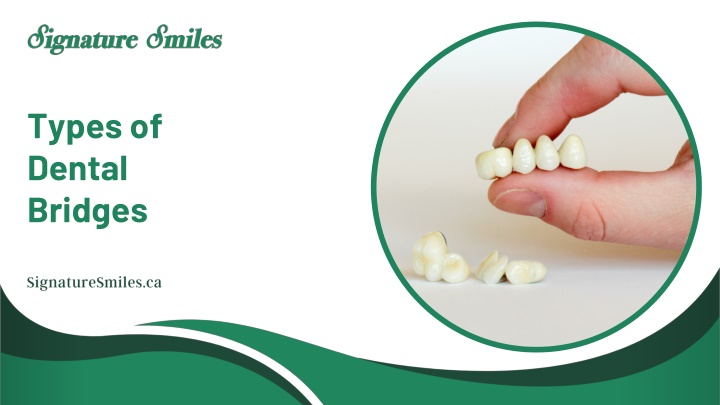 types of dental bridges