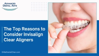 Top Reasons to Choose Invisalign Clear Aligners