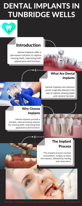 Dental Implants in Tunbridge Wells