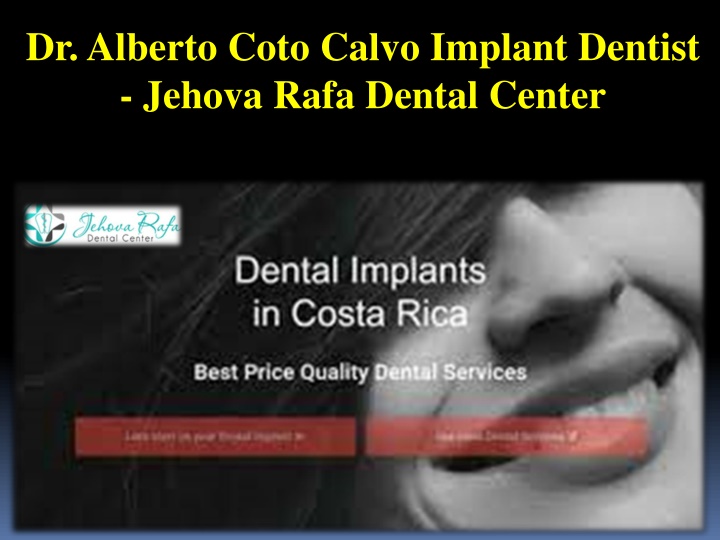 dr alberto coto calvo implant dentist jehova rafa