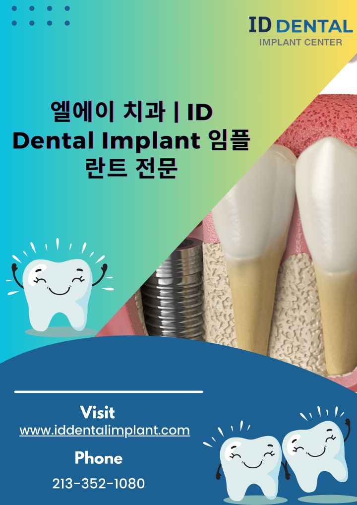 id id id dental implant dental implant dental