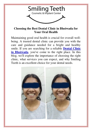 Choosing the Best Dental Clinic in Bhoiwada for Your Oral Health