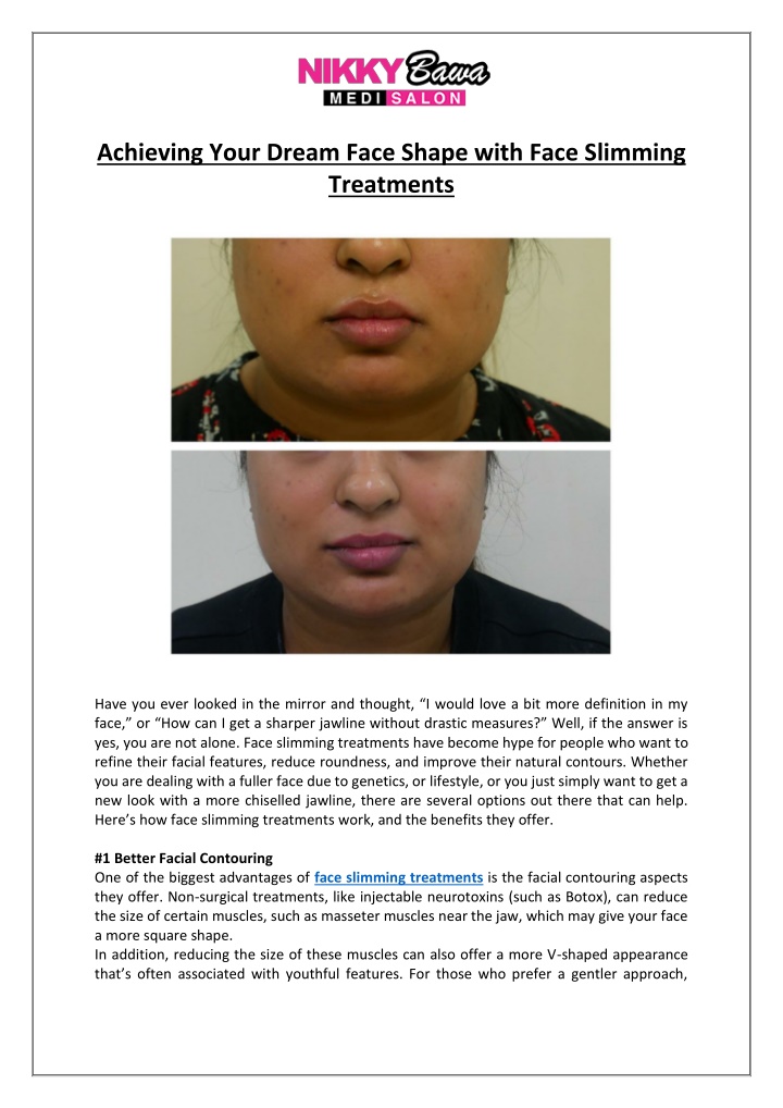 achieving your dream face shape with face