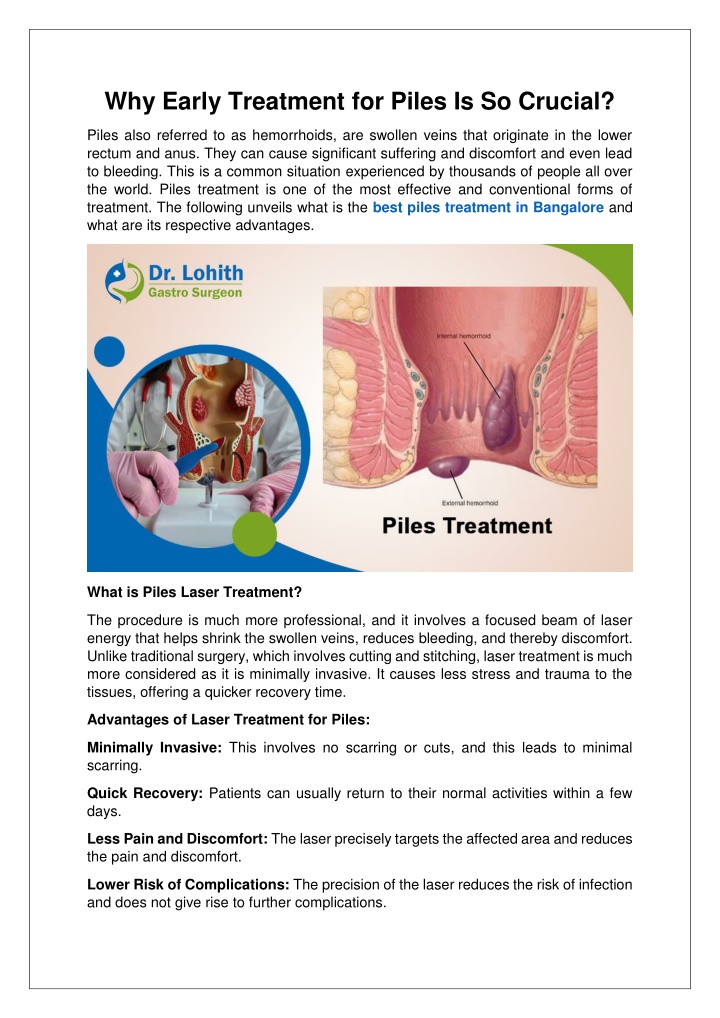 why early treatment for piles is so crucial