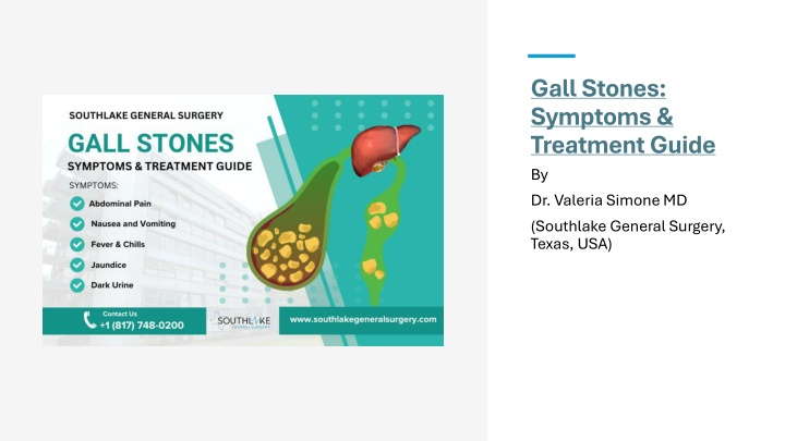 gall stones symptoms treatment guide