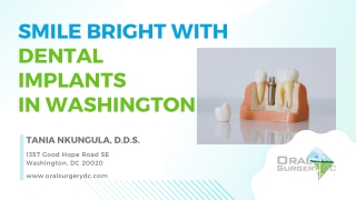 Smile Bright Again with Dental Implants in Washington