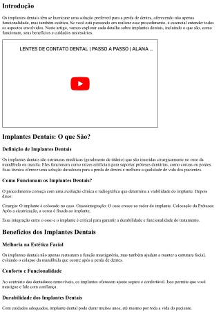 Implantes Dentais: Tudo o que Você Precisa Saber Antes de Realizar o Procediment