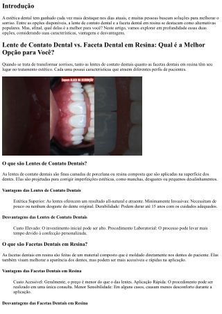 Lente de Contato Dental vs. Faceta Dental em Resina: Qual é a Melhor Opção para