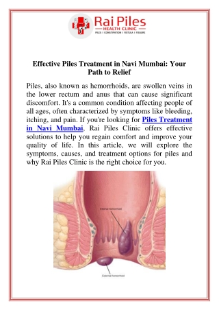 Effective Piles Treatment in Navi Mumbai Your Path to Relief