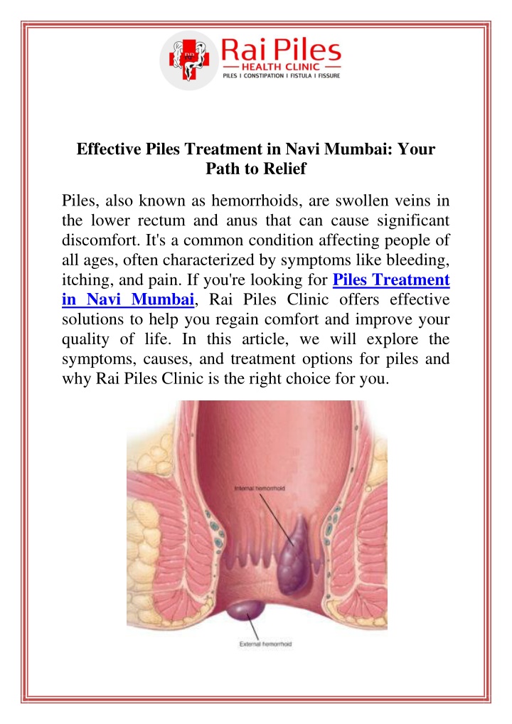 effective piles treatment in navi mumbai your