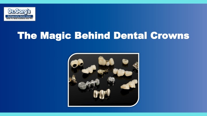 the magic behind dental crowns