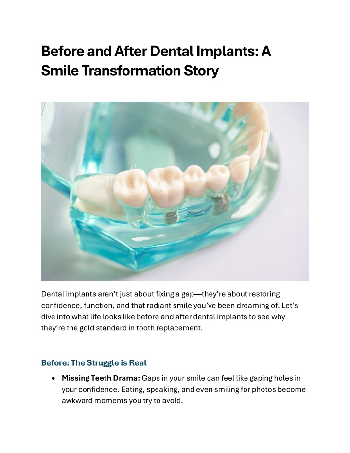 before and after dental implants a smile