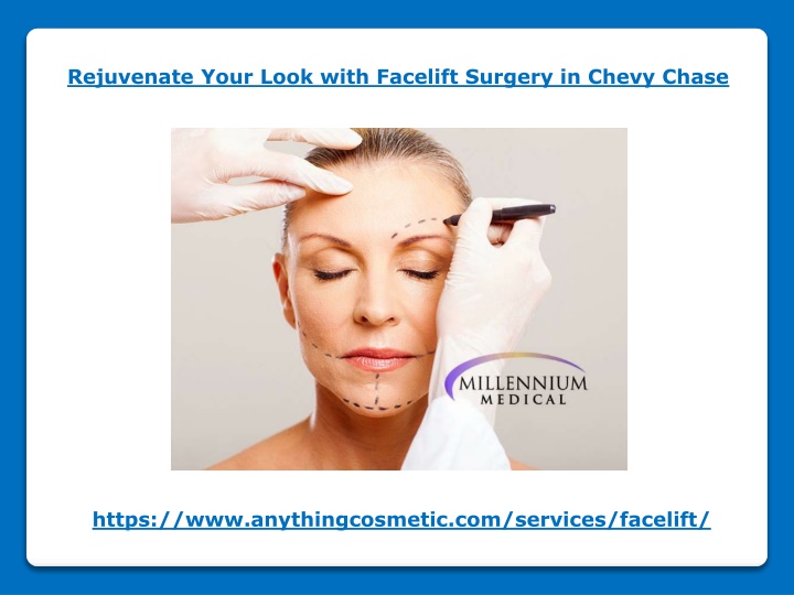 rejuvenate your look with facelift surgery