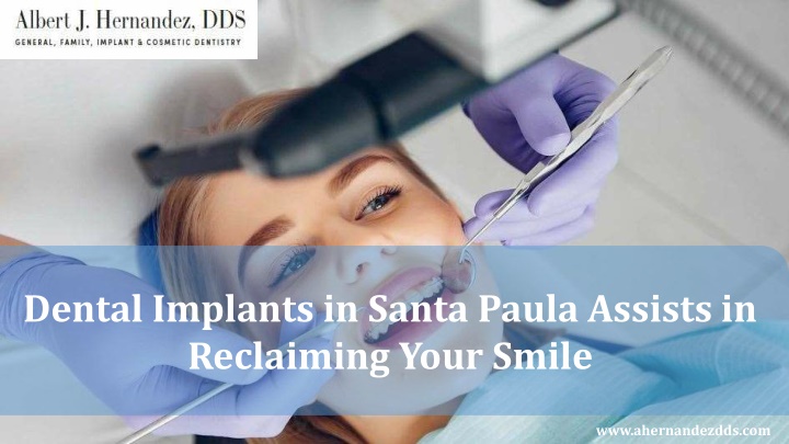 dental implants in santa paula assists