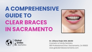 A Comprehensive Guide to Clear Braces in Sacramento