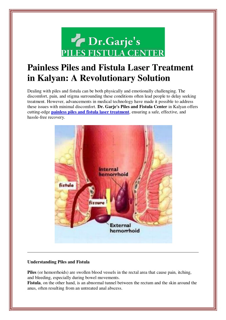 painless piles and fistula laser treatment