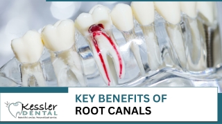 Key Benefits of Root Canals: Saving Smiles, Relieving Pain, and Restoring Oral H