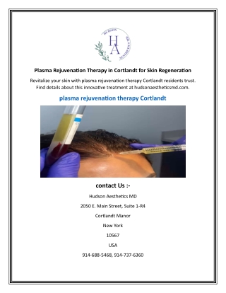 Plasma Rejuvenation Therapy in Cortlandt for Skin Regeneration